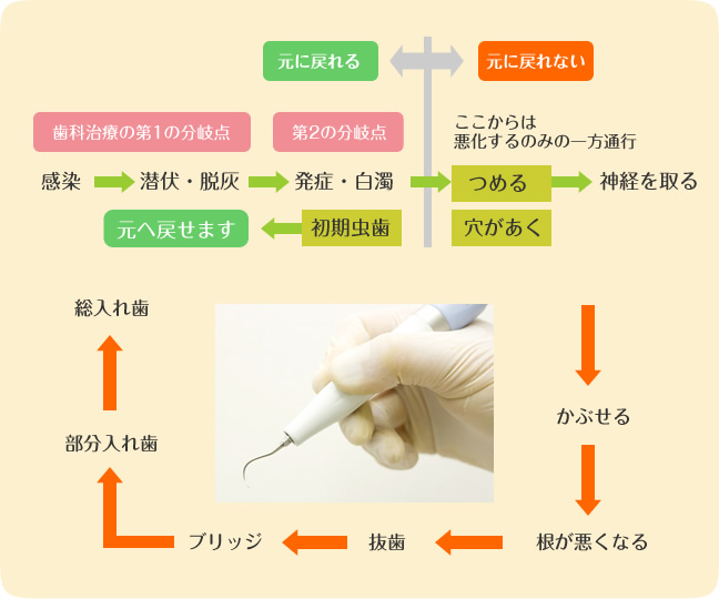 予防歯科について