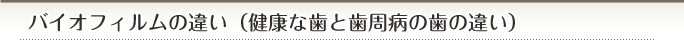 バイオフィルムの違い（健康な歯と歯周病の歯の違い）