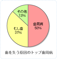 歯を失う原因のトップ 歯周病