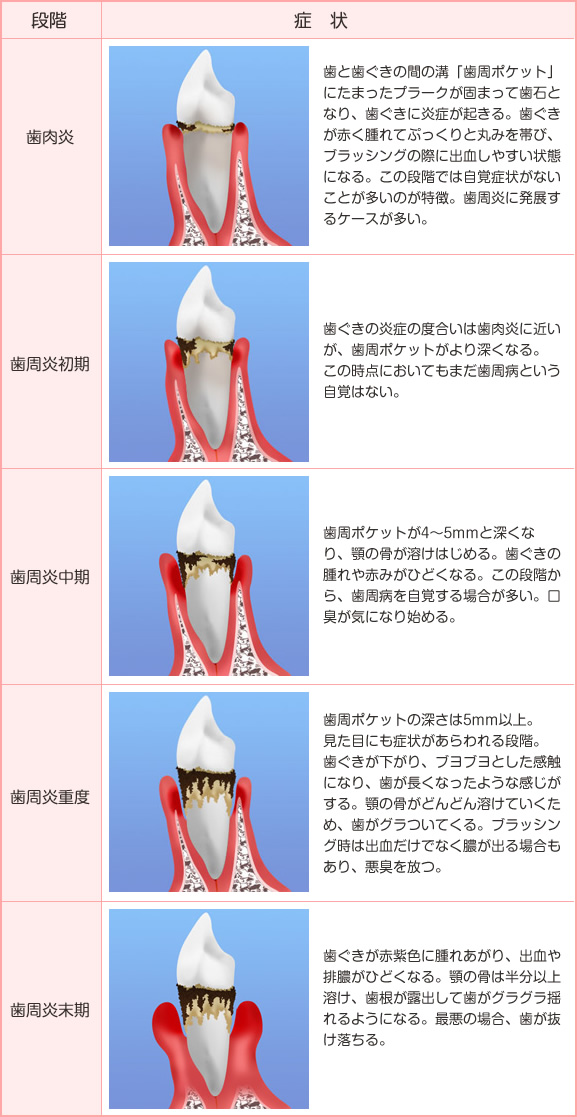 進行具合